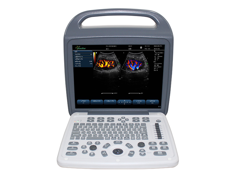 C10m المحمولة لون دوبلر بالموجات فوق الصوتية بالموجات فوق الصوتية جهاز التشخيص