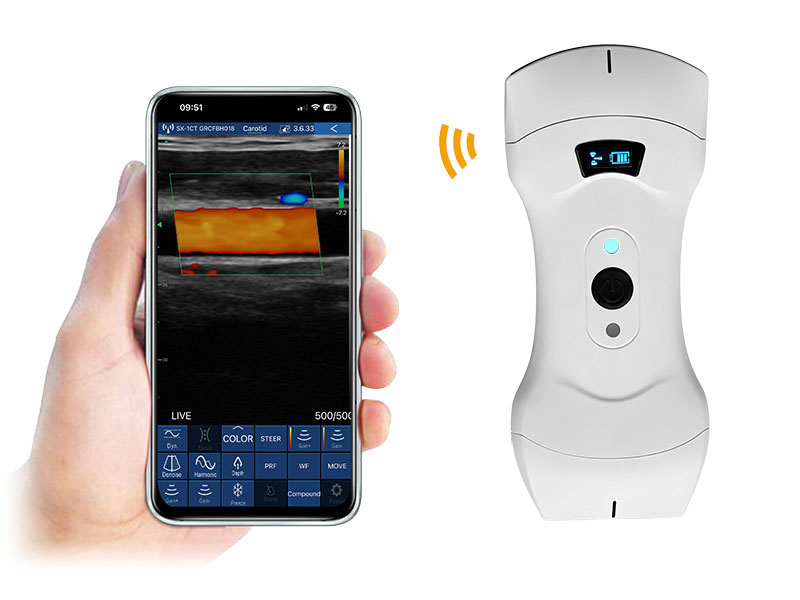 6CPL  Plus 3in1 ماسح الموجات فوق الصوتية دوبلر النخيل